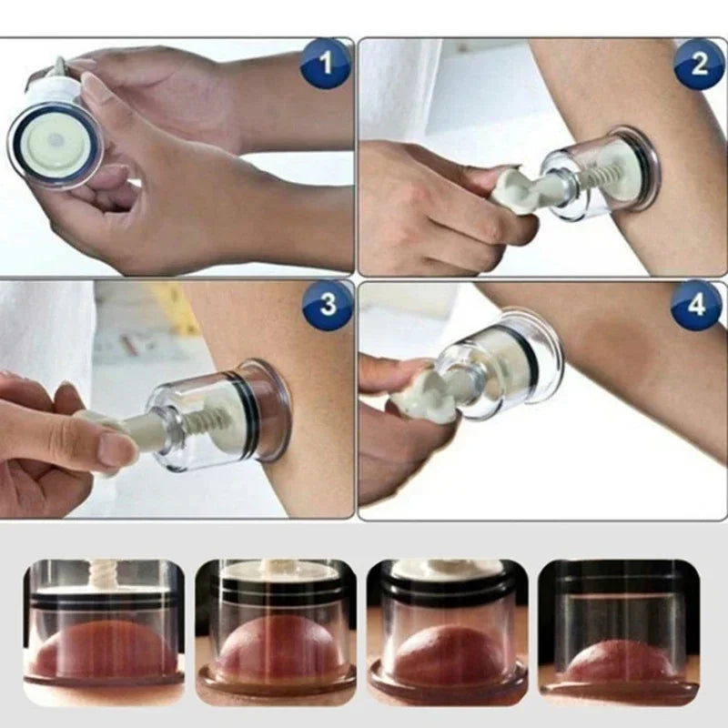 Vacuum Suction Cupping Cups